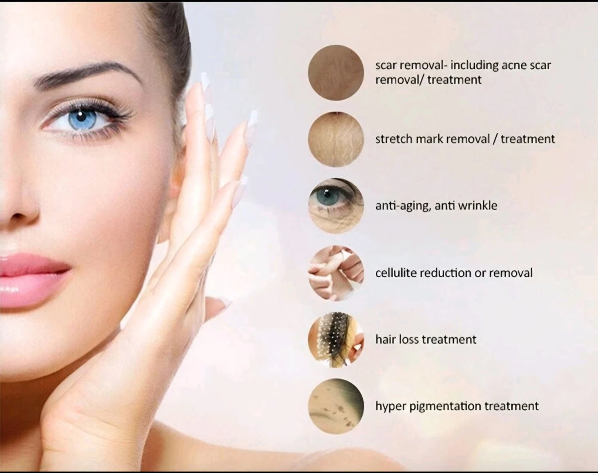 Share DERMA SKIN ROLLER 540 TITANIUM MICRO NEEDLE ANTI AGEING HAIR (ONLY 0.5M)